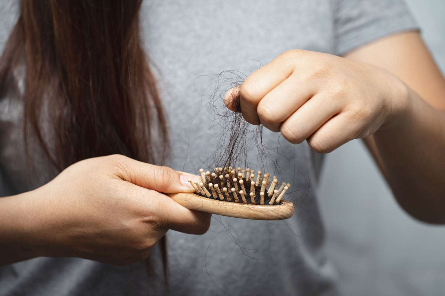 La caduta dei capelli nei giovani: come intervenire