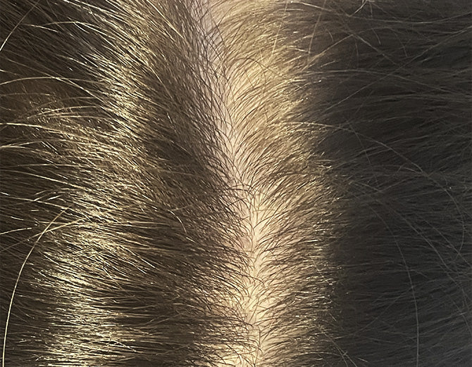 Dettaglio del cuoio capelluto con diradamento visibile: situazione iniziale prima del trattamento Bioscalin® TOTAL•CARE.