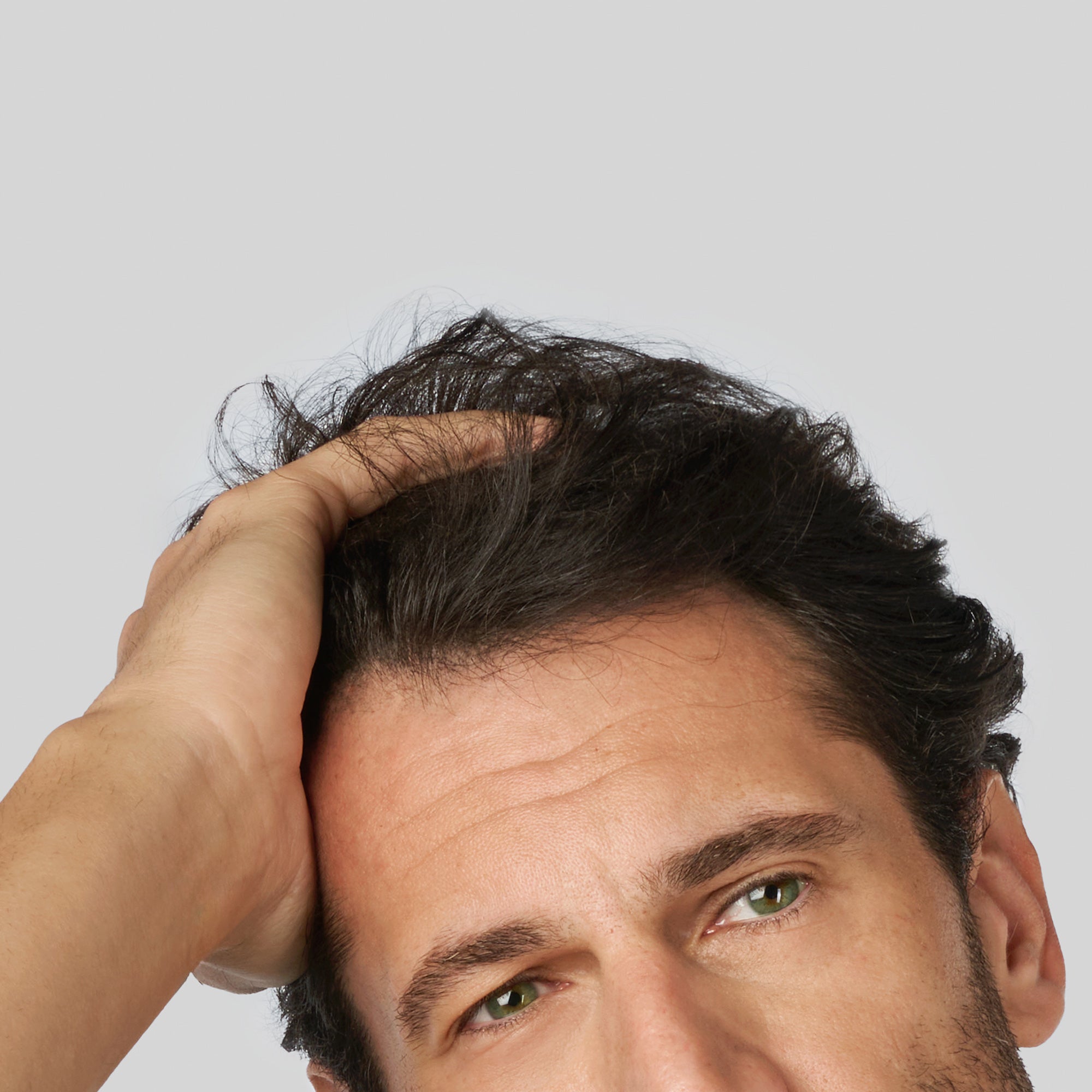 Uomo che mostra l’attaccatura dei capelli spostando la chioma all’indietro