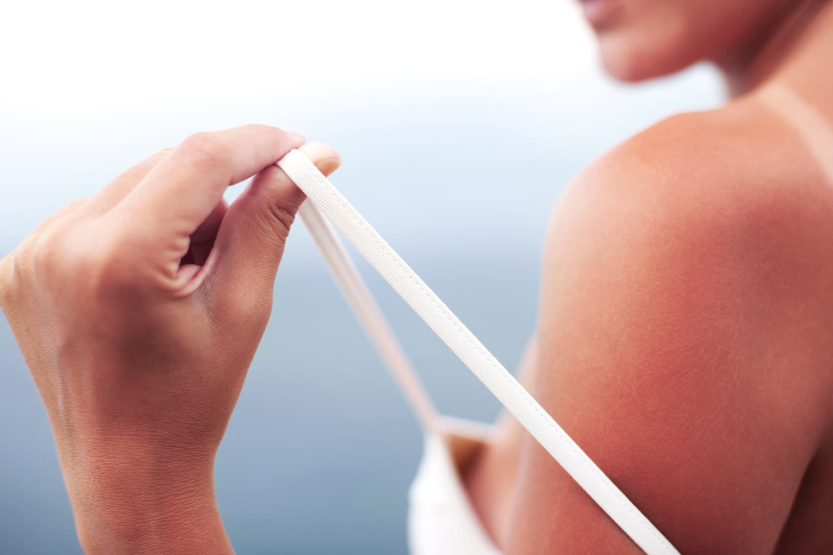 prevenire gli eritemi