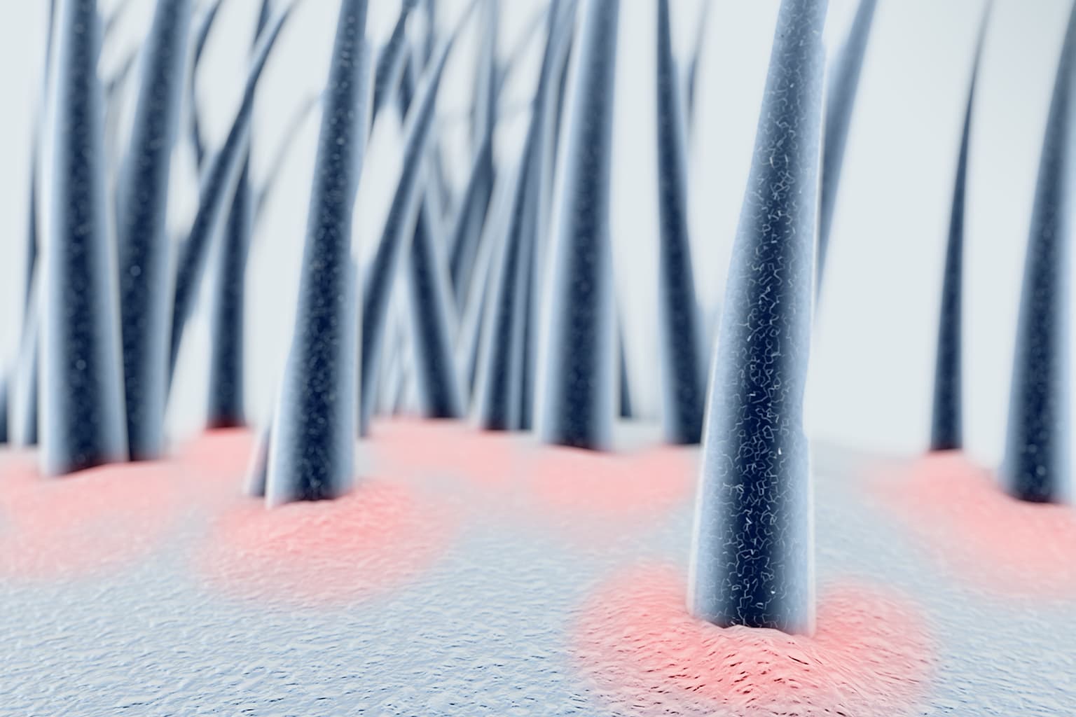 CUOIO CAPELLUTO E CAPELLI: COME CAMBIANO IN BASE AGLI ORMONI