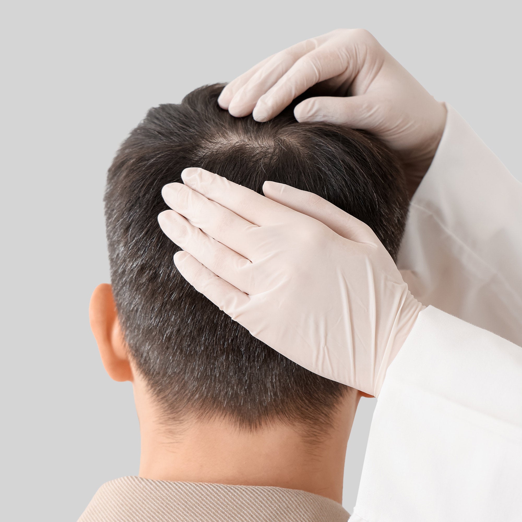 Medico che esamina il cuoio capelluto di un uomo durante un controllo professionale