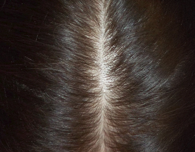 Risultato dopo il trattamento Bioscalin® MENOPAUSA: chioma visibilmente più folta e forte