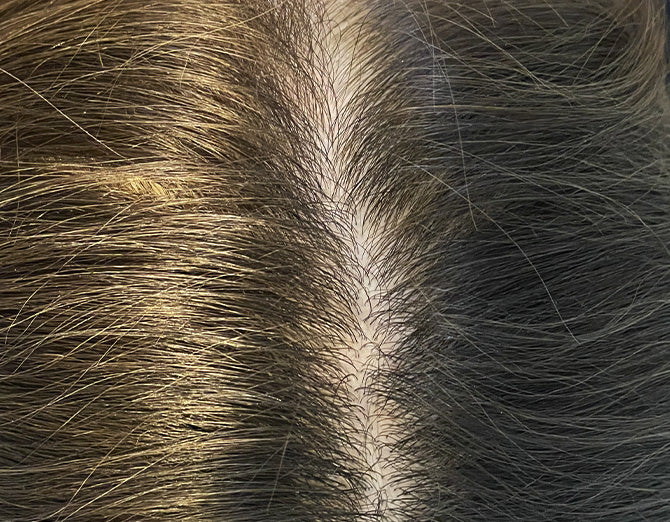 Risultato dopo il trattamento Bioscalin® TOTAL•CARE: chioma visibilmente più densa, folta e forte.